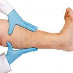 Нога и руки врача в перчатках