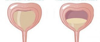 Normal and overactive bladder