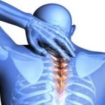 Опасно ли защемление нерва в шейном отделе?