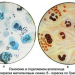Определение бактерий