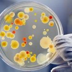 The main reasons are microbes and inflammation