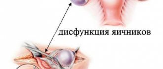 Main signs and symptoms of ovarian dysfunction