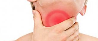 acute tonsillitis