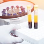 blood plasma separation for analysis