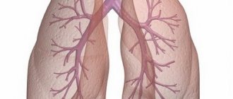 pulmonary edema description