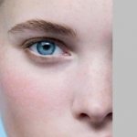 почему отекает лицо