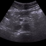 Preparing for an abdominal ultrasound: what can and cannot be eaten? snikom_uzi_brushnoy_polosti 