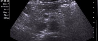 Preparing for an abdominal ultrasound: what can and cannot be eaten? snikom_uzi_brushnoy_polosti