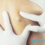 The reason lies in the accelerated release of testosterones