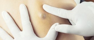 Причина кроется в ускоренном выделении тестостеронов