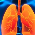 Causes of aspiration pneumonia