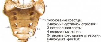 Причины боли в крестце у женщин