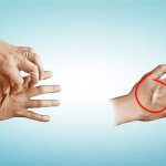 signs of dehydration