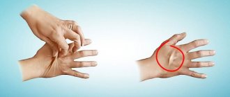 signs of dehydration