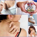 Contraindications to the use of miconazole