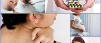 Contraindications to the use of miconazole
