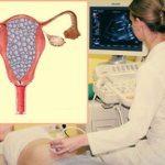 Пузырный занос - симптомы