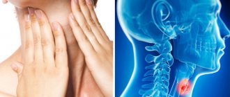 throat cancer symptoms in women