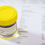 interpretation of urine analysis in children