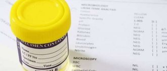 interpretation of urine analysis in children