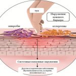 Развитие аллергического дерматита у ребёнка может стать предвестником более серьёзных заболеваний