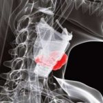 Ultrasound results of the thyroid gland: how are they interpreted? - subtleties of non-invasive studies of the human body on ForeverHealth.ru 