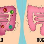 waste in the intestines