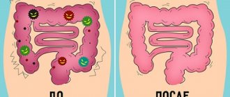 waste in the intestines