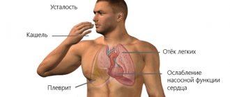 Симптомы сердечной недостаточности