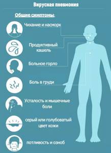 симптомы вирусной пневмонии