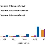 Edwards syndrome photo