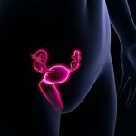 Premature ovarian failure syndrome