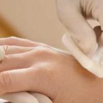 Hand-foot-mouth syndrome - what is it?