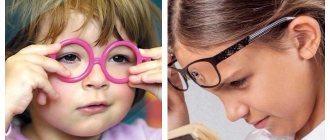 Spasm of accommodation of the eye