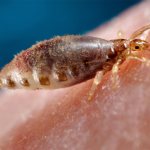 This is what parasites look like on a large scale, which can cause an itchy scalp.