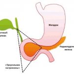 «Треугольник гастриномы»