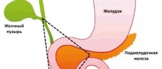 &quot;Triangle of gastrinoma&quot;