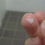 Творожистые выделения