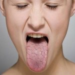 У девушки трещины на языке