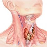 Узлы в щитовидке