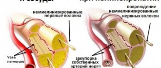 Diabetic neuropathy is caused by damage to the smallest blood vessels
