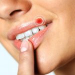 Valtrex instructions for use price reviews analogues