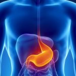 Варикоз желудка