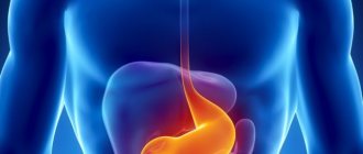 Varicose veins of the stomach