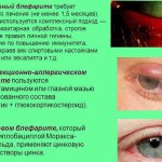 Types of blepharitis
