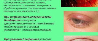 Types of blepharitis