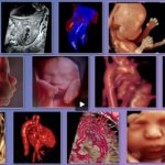 Врожденные аномалии и хромосомные нарушения плода