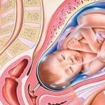 Congenital and genetic diseases