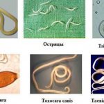 Всего насчитывается более 250 основных видов человеческих гельминтов