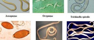 There are more than 250 major species of human helminths
